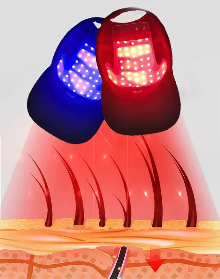 Red light therapy cap targeting thinning hair & hair loss, promoting scalp health and stimulating natural hair growth.