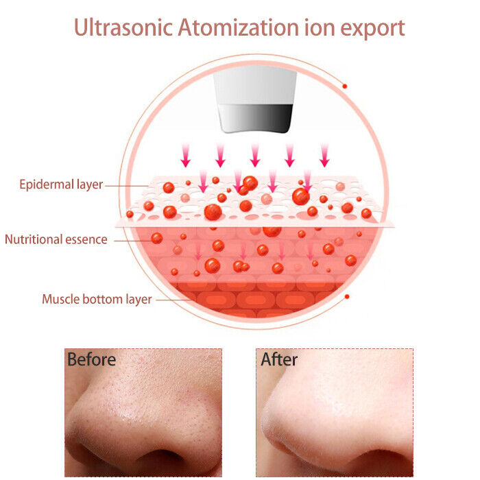 Reveal clearer, healthier skin with this ultrasonic facial pore cleaner. Deep cleansing & exfoliation beauty tool.